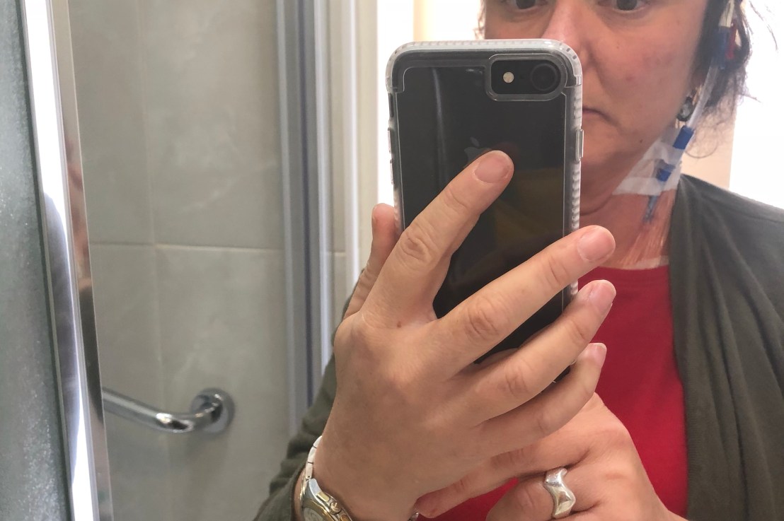 Hair loss & perceptions of&nbsp;beauty